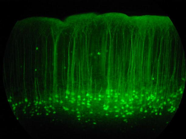 peitsitud neuronid